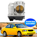Drosselklappengehäuse 16119-AU003 für Nissan Sentra 1.8L 2002–2006